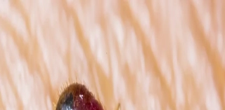 What Do Dead Bedbugs Mean?